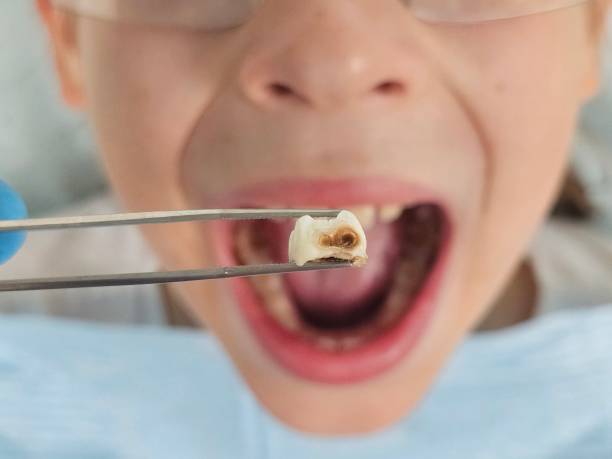 Best Emergency Treatment for Toothache in Parsons, TN