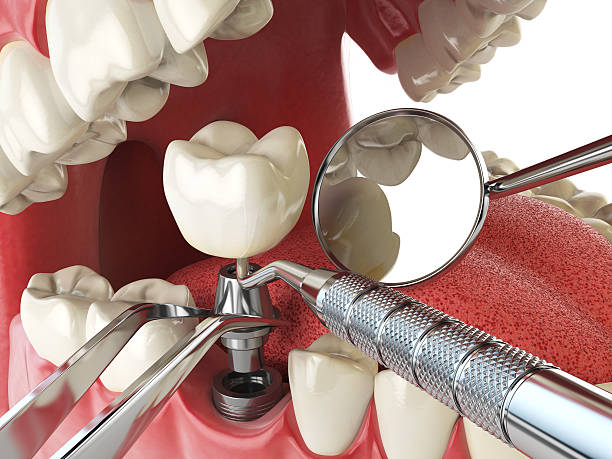 Best Same-Day Emergency Dentist in Parsons, TN