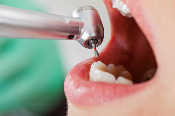 Best Emergency Dental Surgery in Parsons, TN